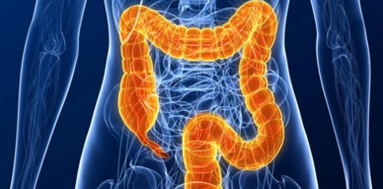 Qual'è la forza dello screening nei tumori del colon-retto?